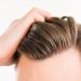 Nourkrin contains natural ingredients and has been clinically proven to help thinning hair –