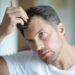 How can I regrow my hair loss?