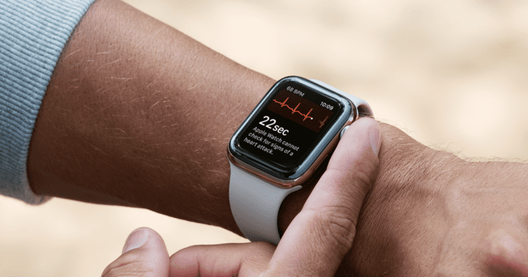 Here are the five best reasons why you should buy an Apple Smartwatch