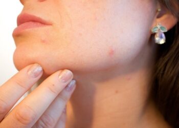 Clear Skin Awaits: Discover Acne Solutions at The Independent Pharmacy!