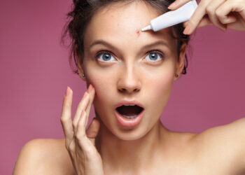 Mastering Acne: Your Guide to Effective Treatments from The Independent Pharmacy