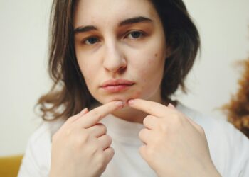 Discover the Best Skincare Solutions for Combatting Acne and Dryness