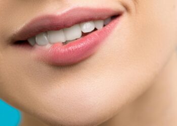 Unlock a Brighter Smile With Safe and Effective Whitening Solutions