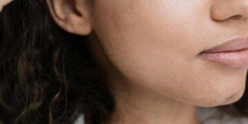 Anti-Aging-Hautpflegelösungen, die Ihre Haut schützen und revitalisieren