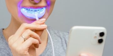 Direct Teeth Whitening for a Brighter and Confident Smile