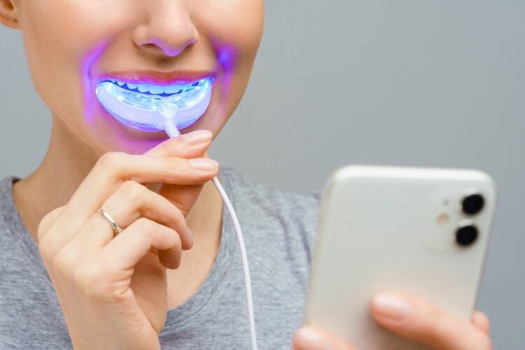 Direct Teeth Whitening for a Brighter and Confident Smile