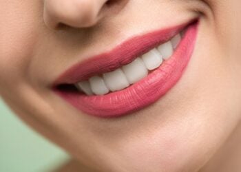 Achieve A Radiant Smile By Starting Your Whitening Journey