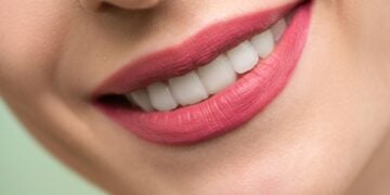 Achieve A Radiant Smile By Starting Your Whitening Journey