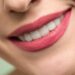 Achieve A Radiant Smile By Starting Your Whitening Journey